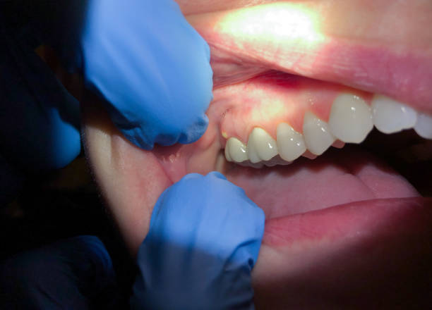 Best Emergency Cosmetic Dentistry (e.g., broken veneers) in Raytown, MO